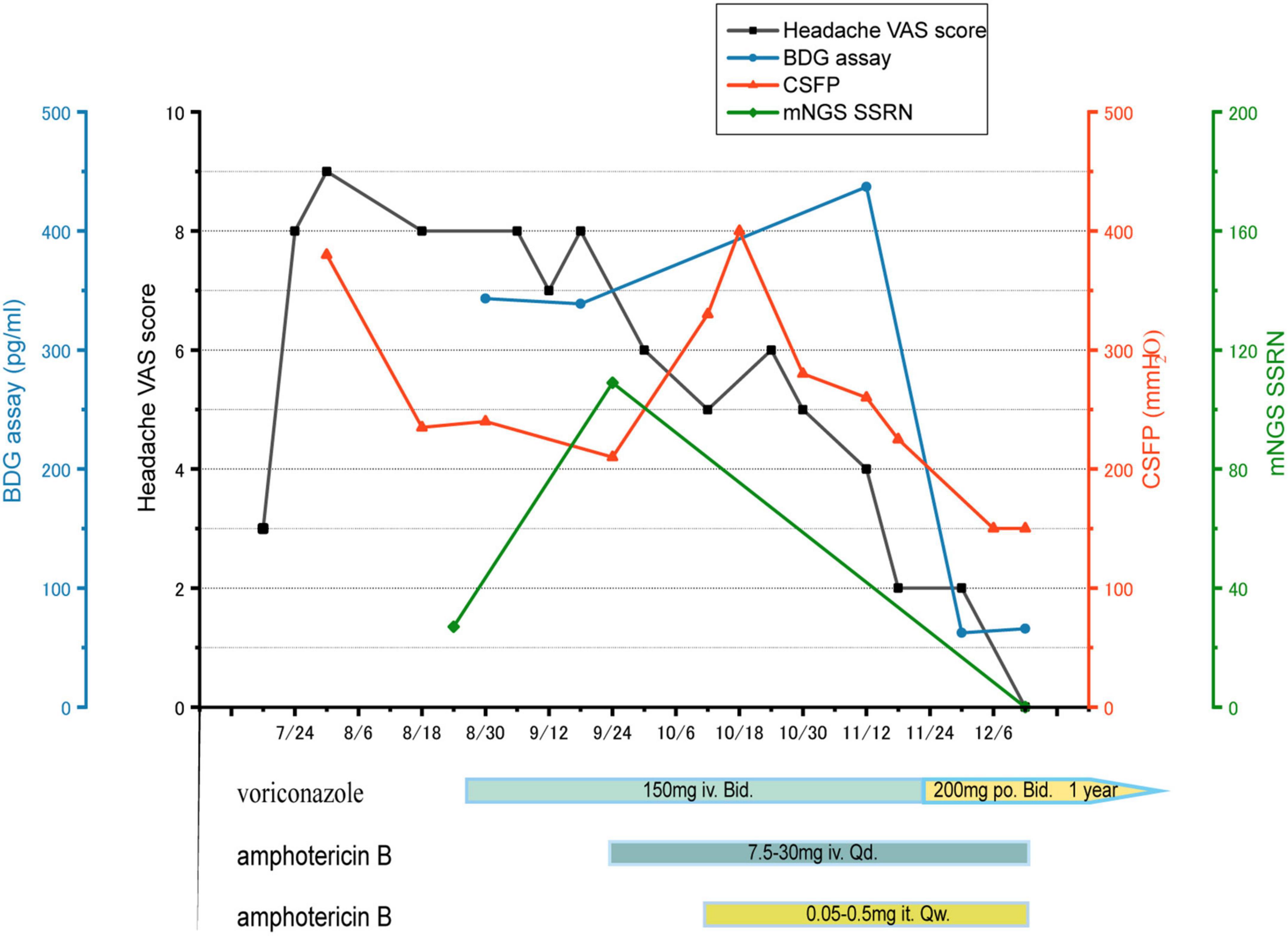 Cerebral aspergillosis after heart-lung transplantation in a child: Case report with 3-year follow-up and literature review